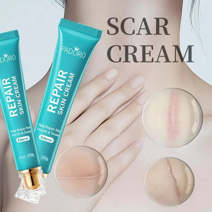 [Buy 1 Get 1] Repair Scar Cream - Randomly Send Scar Removal Cream or Liquid, 20g
