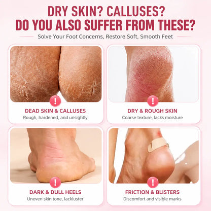 Reusable Silicone Foot Care Socks – Moisturizing Heel Mask Socks for Dry Cracked Feet, Soft Gel Foot Covers, Home Spa Pedicure Treatment