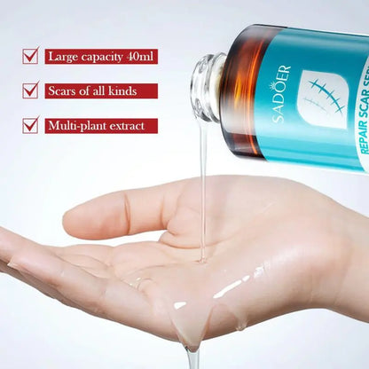 [Buy 1 Get 1] Repair Scar Cream - Randomly Send Scar Removal Cream or Liquid, 20g